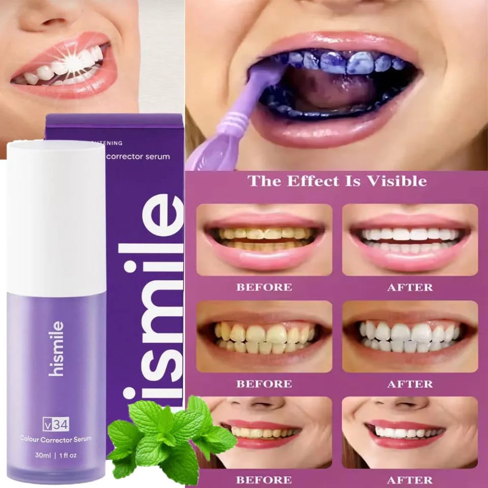 HISMILE V34 COLOUR CORRECTOR SERUM – INSTANT TEETH BRIGHTENING SERUM (30ML)